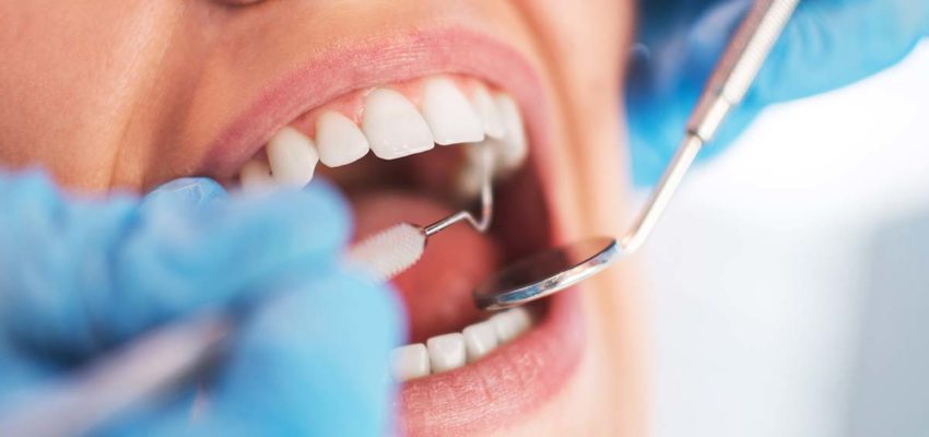 Why You Should Avoid Root Canals Like The Plague