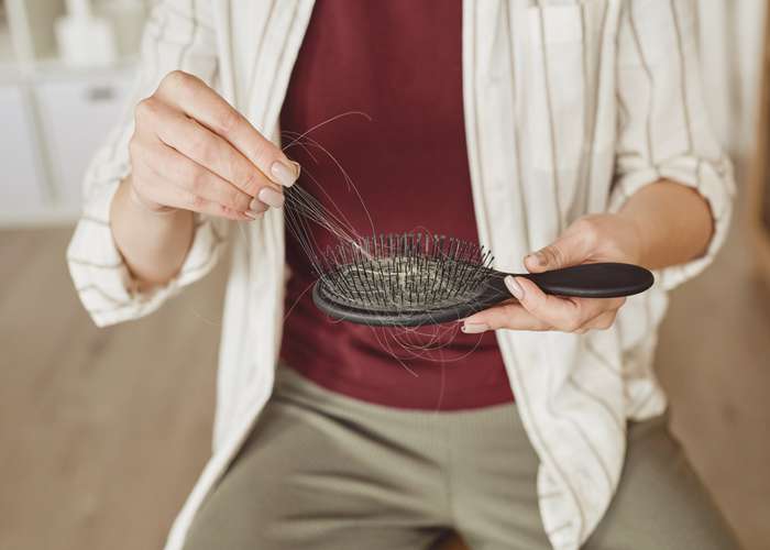 Man losing hair. Hairbrush full of hair after brushing which is a sign of losing hair.