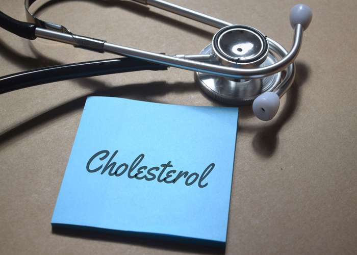 Cholesterol written on a piece of paper in a clinic. Medical check up for cholesterol. Concept: high cholesterol.
