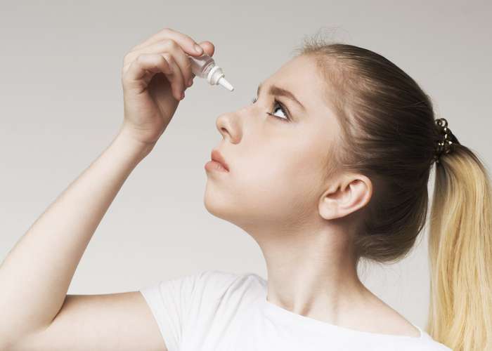 Girl suffering from dry eye syndrome putting eye drops to lubricate the eye.