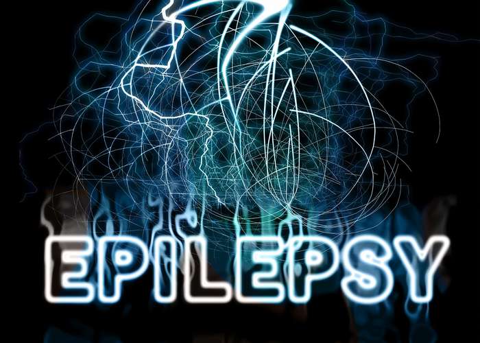 Epilepsy abnormal electricity in the brain, triggering cells hyperexcitable and causing epilepsy seizures.