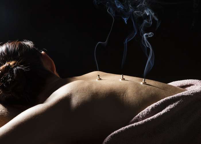Woman laying on bed, doing moxibustion. Therapy includes burning moxa, ground mugwort to warm certain points in the body.