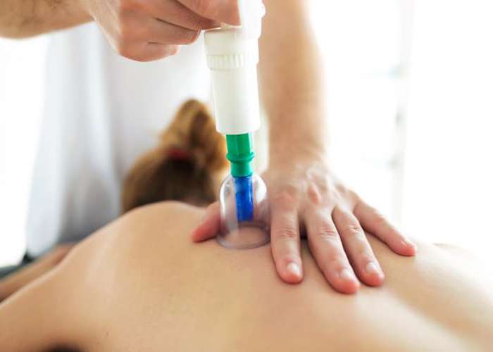 Cupping for chronic pain: use, benefits, and precautions. Why cupping (Hijama) helps reduce pain.