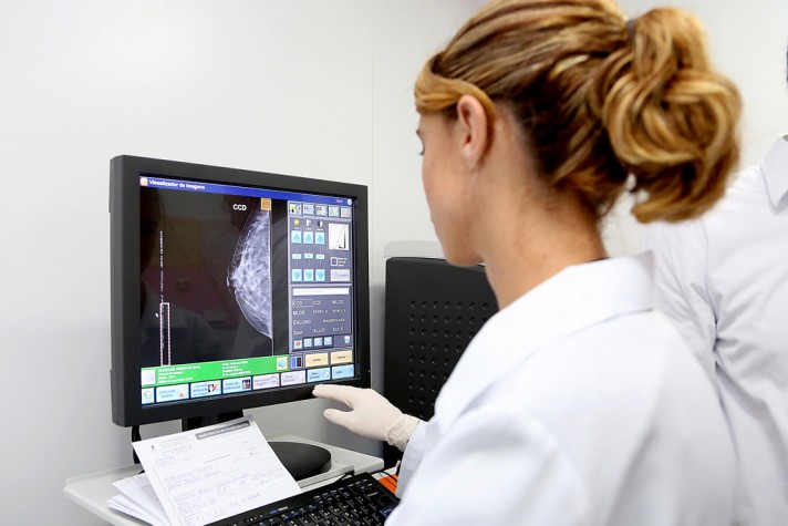mamografia-beneficios