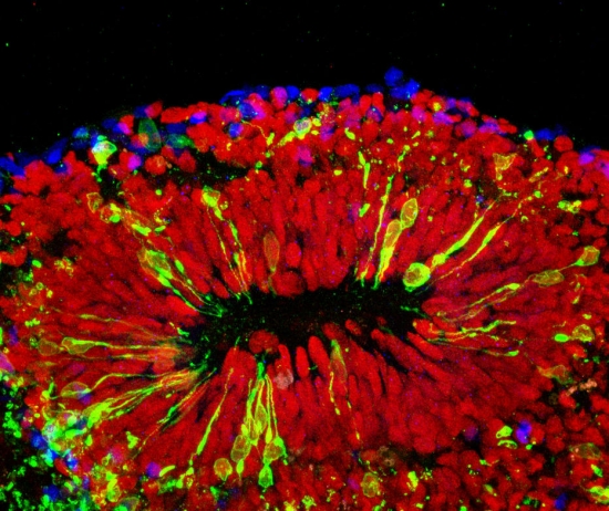 Estudo comprova zika tem preferencia por celulas tronco neurais