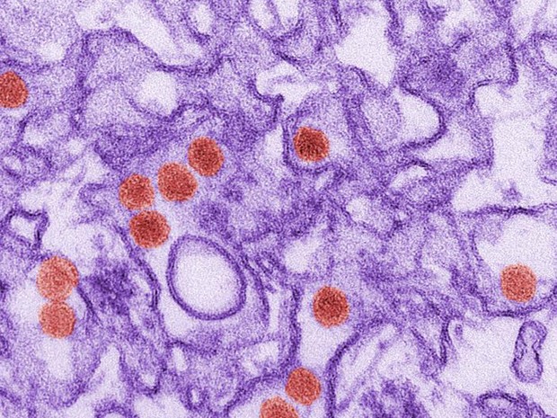 Florida ja temados por virus da zika  133  infectados CDC Cynthia