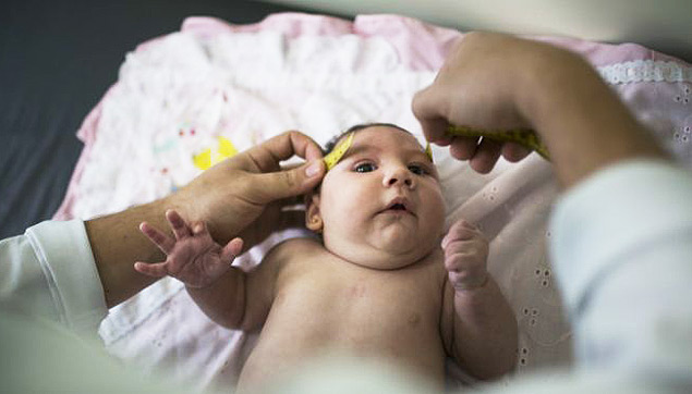 Nova York registra primeiro caso de microcefalia Folha foto BBC associated Press