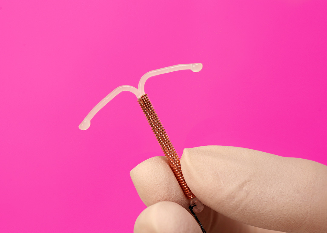 O dispositivo intrauterino (DIU) é um pequeno objeto de plástico em formato de T inserido no útero para atuar como contraceptivo. Foto: Freepik