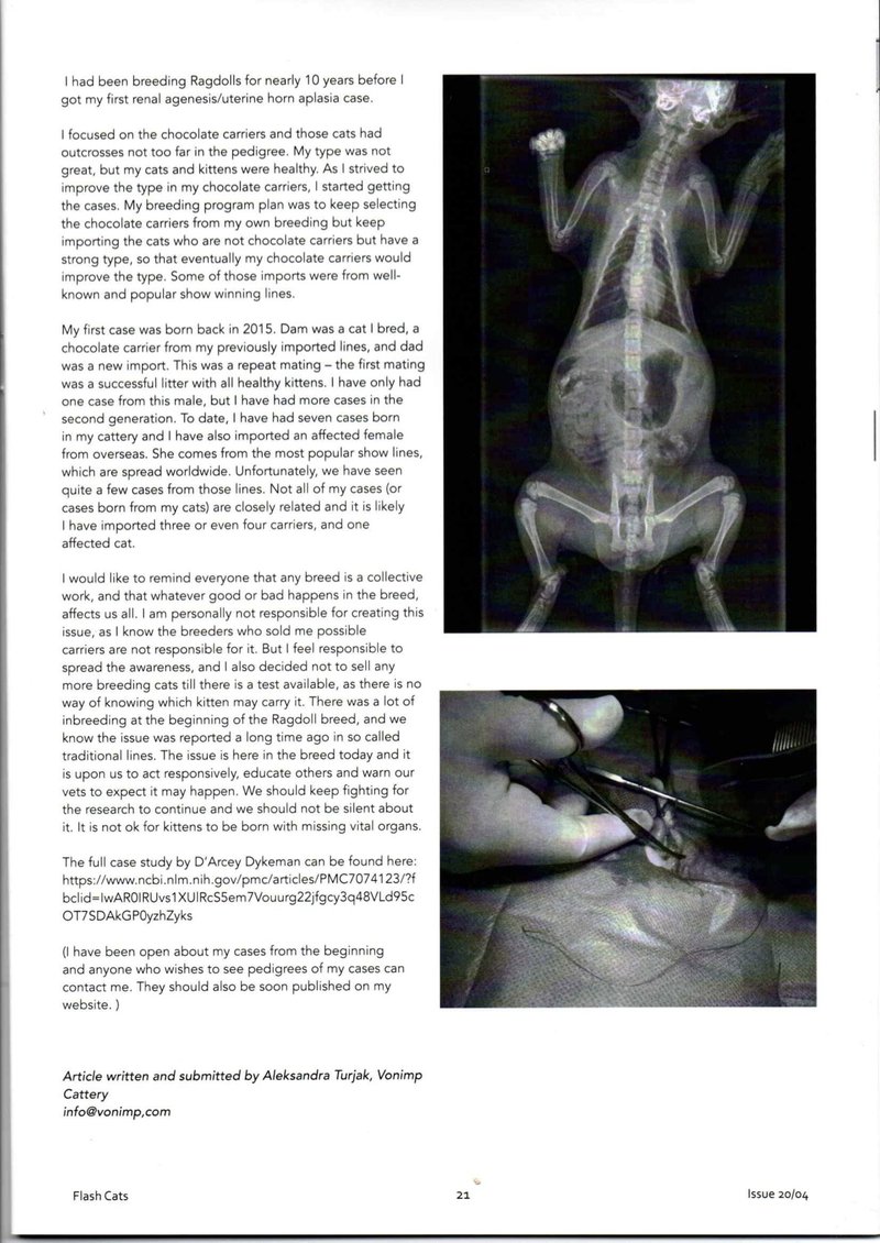 One kidney article page 1.jpg