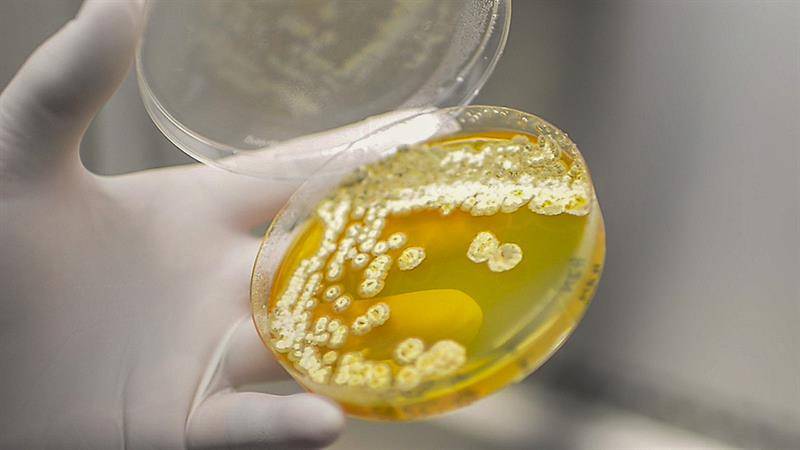 Un aspecto del trabajo de investigación que en una colaboración científica con las universidades de Harvard y de Wisconsin descubrieron en Costa Rica de un nuevo antibiótico, Selvamicina, identificada a partir de una bacteria asociada a las hormigas del género Apterostigma y que cuenta con propiedades para atacar hongos que afectan a los humanos. EFE/ UCR