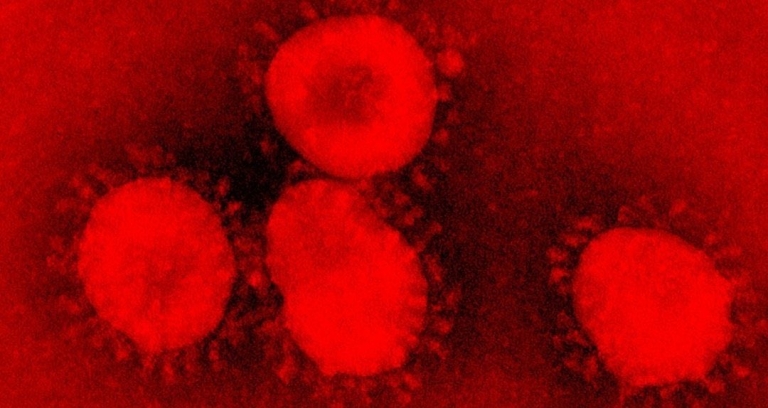 Xi Jinping asegura que China superará el coronavirus (Boletín)