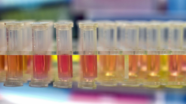 Laboratorio para producir vacunas anti covid-19 en India. TW