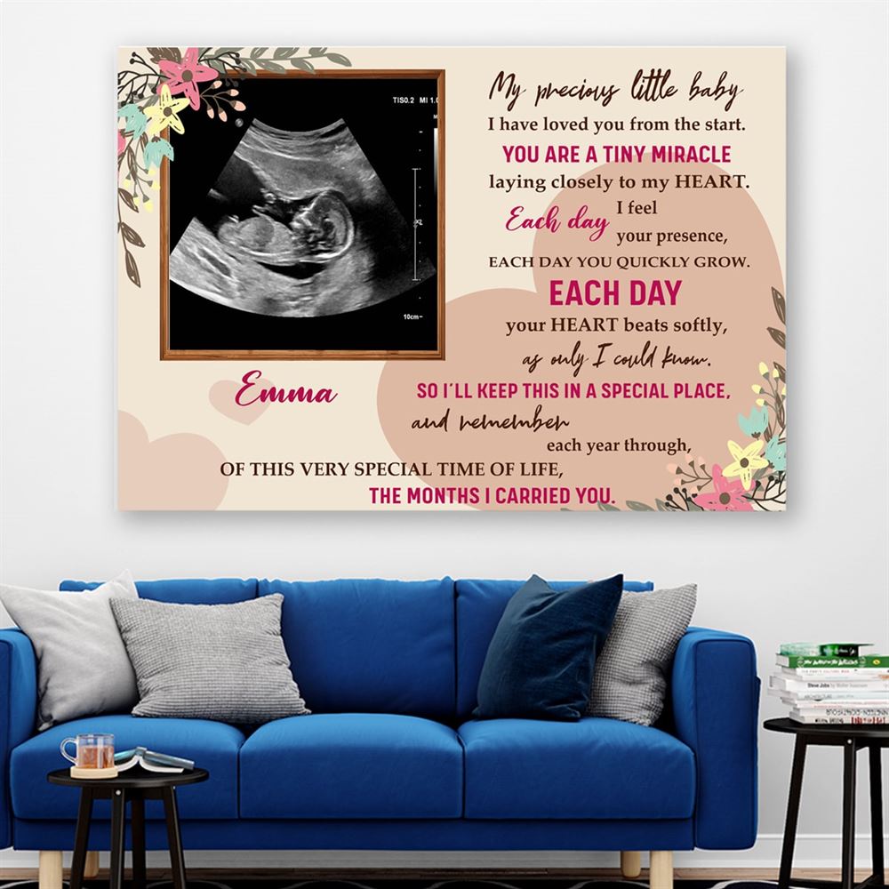 Personalized My Precious Little Baby Mug Sonogram Canvas Poster Pregnancy Ultrasound Gift For New Mom Dad