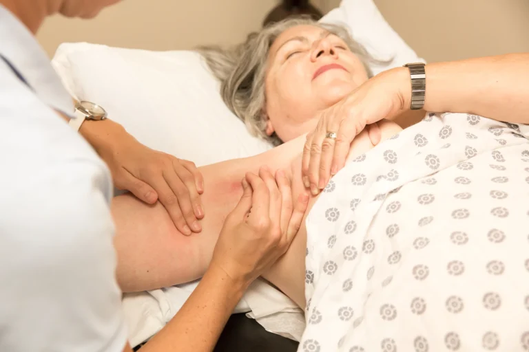 Linfedema después del cáncer: por qué aparece y qué significa realmente