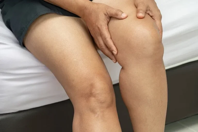 Dolor, hinchazón, hematomas… ¿puede ser lipedema?