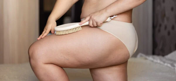 Abordaje integral del lipedema: por qué no existe una única solución