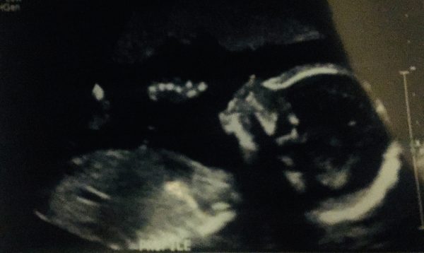 Spring 2019 baby girl ultrasound