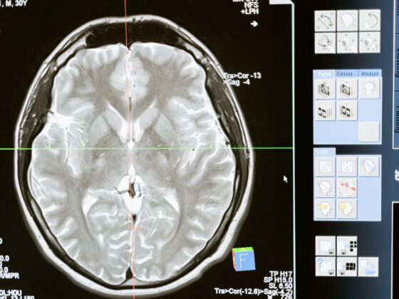 technology computer head health